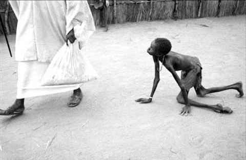 starving-child
