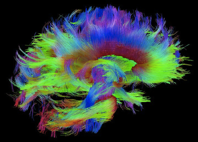 "White matter fiber architecture from the Connectome Scanner dataset. The fibers are color-coded by direction: red = left-right, green = anterior-posterior, blue = ascending-descending (RGB=XYZ)." - www.humanconnectomeproject.org